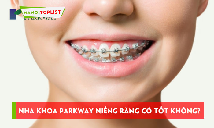 nha-khoa-parkway-nieng-rang-co-tot-va-uy-tin-khong-hanoitoplist