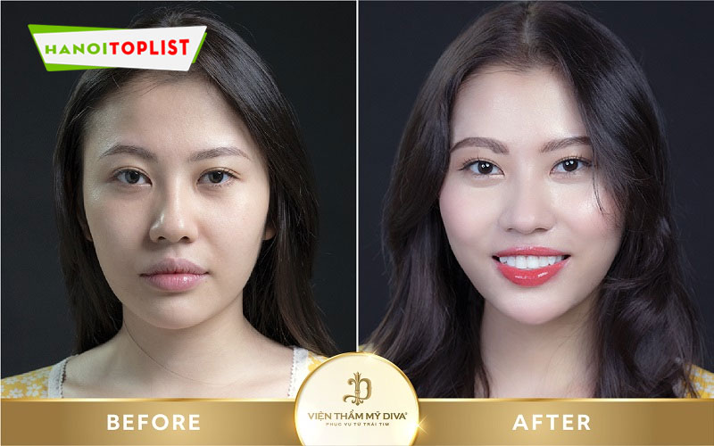 co-nen-phun-xam-moi-hay-khong-hanoitoplist