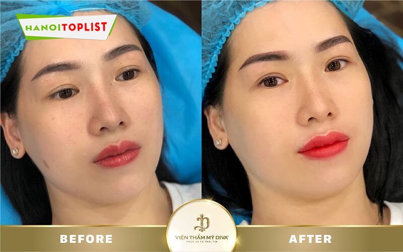 nhung-dieu-can-luu-y-khi-su-dung-dich-vu-phun-xam-moi-hanoitoplist